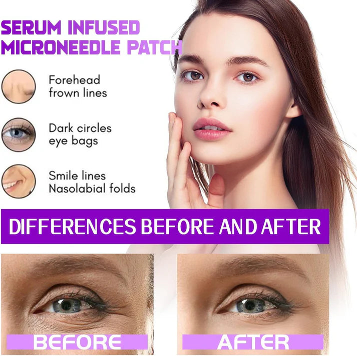 DERMELLE™ Lifting Microneedle Patches