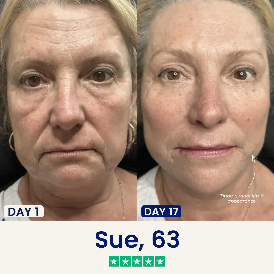 Dermelle Jawline Sculpting Mask