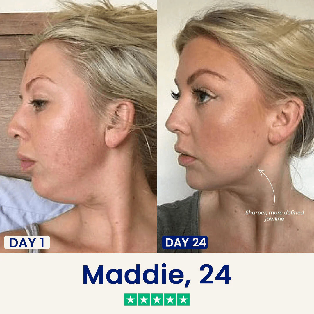 Dermelle Jawline Sculpting Mask